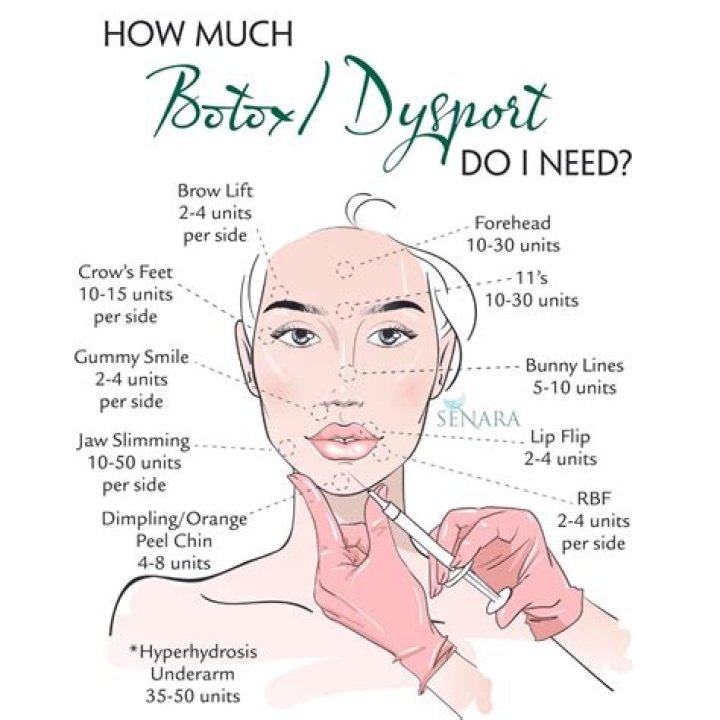 100 units of dysport equals how much botox