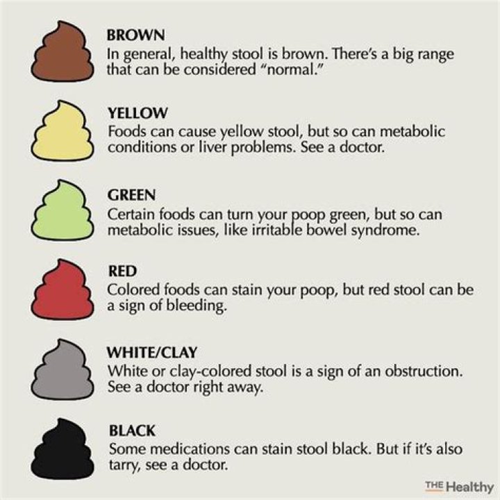 clay colored stool causes