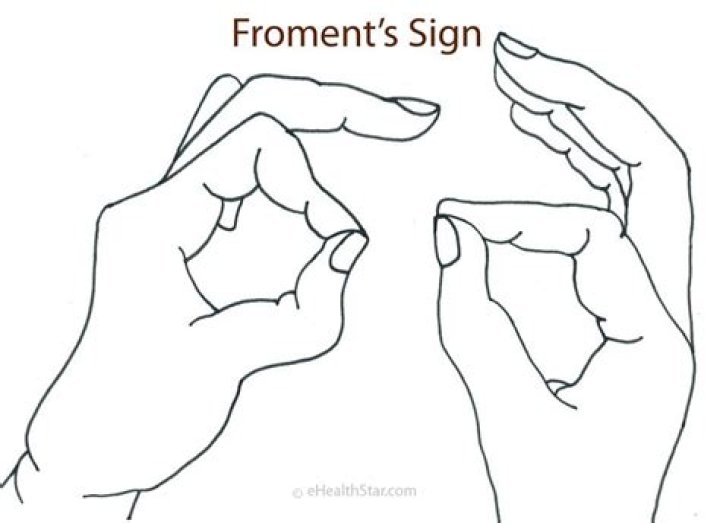 froments sign