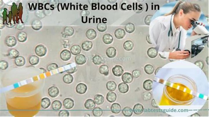 high white blood cells in urine