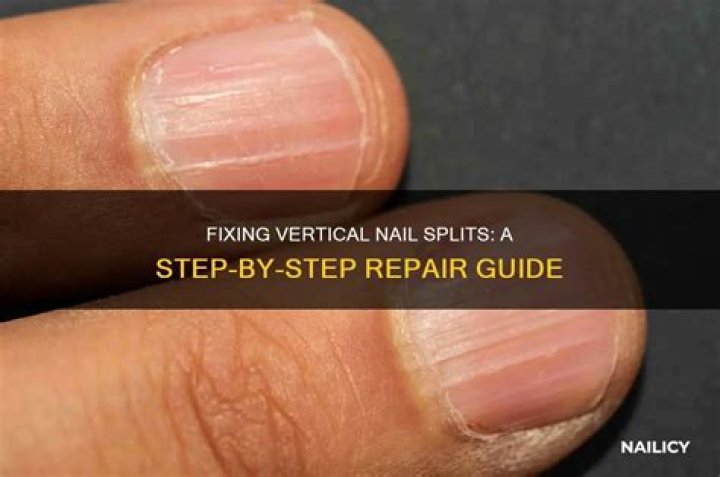 how do i stop my nails from splitting vertically