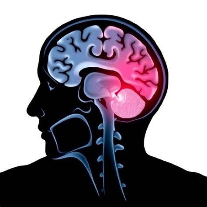 icd 10 code for ischemic stroke