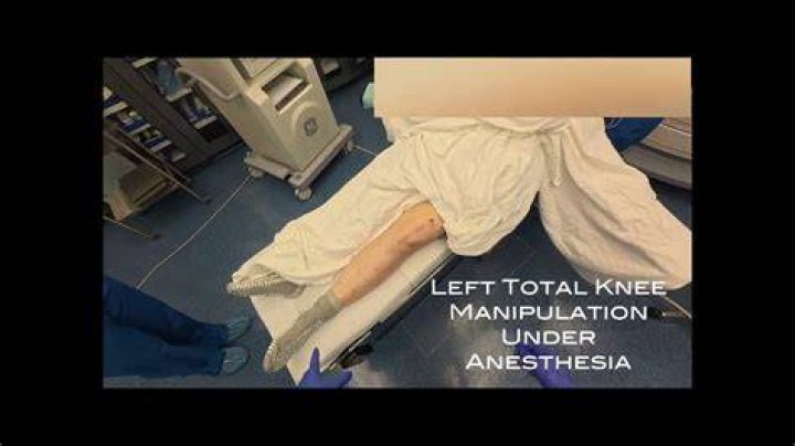 knee manipulation