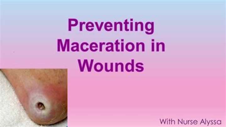 maceration wound
