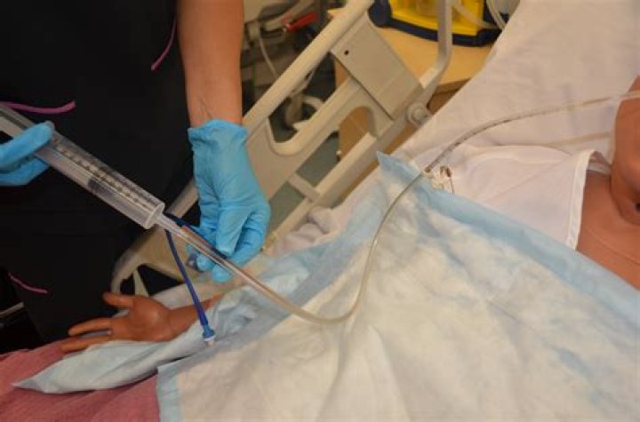 ng tube suction