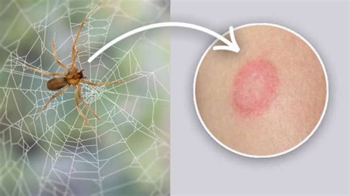 spider bite red circle