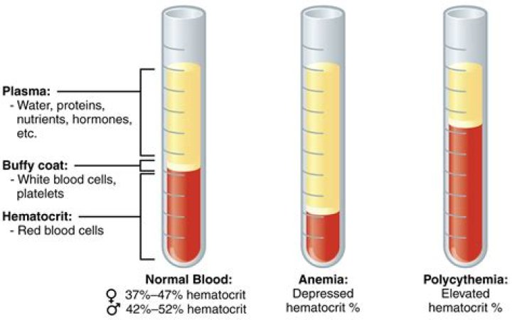 what does it mean if your hematocrit is high?