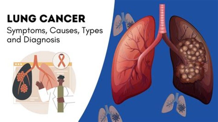 what does lung cancer look like