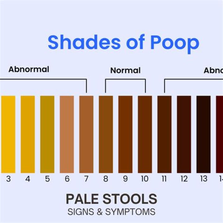 what does pale stool look like